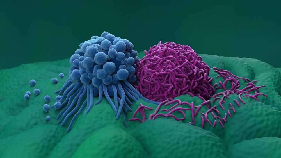 Tislelizumab (Tevimbra) Nedir? FDA Onayı, Türkiye Ruhsatı ve Geri Ödeme Durumu