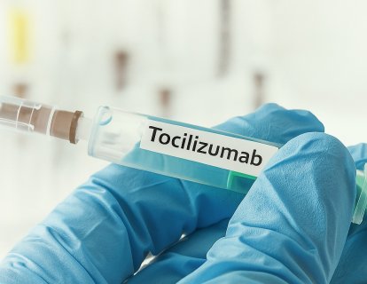 Tocilizumab (Actemra) Nedir? Kanser Tedavisinde Ne İçin Kullanılır? 