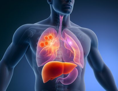 Tremelimumab-actl (Imjudo) Nedir? FDA Onayı, Türkiye Ruhsatı ve Geri Ödeme Durumu