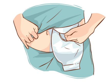 Ürostomi Nedir? Ameliyatı Nasıl Yapılır? Torbasının Bakımı