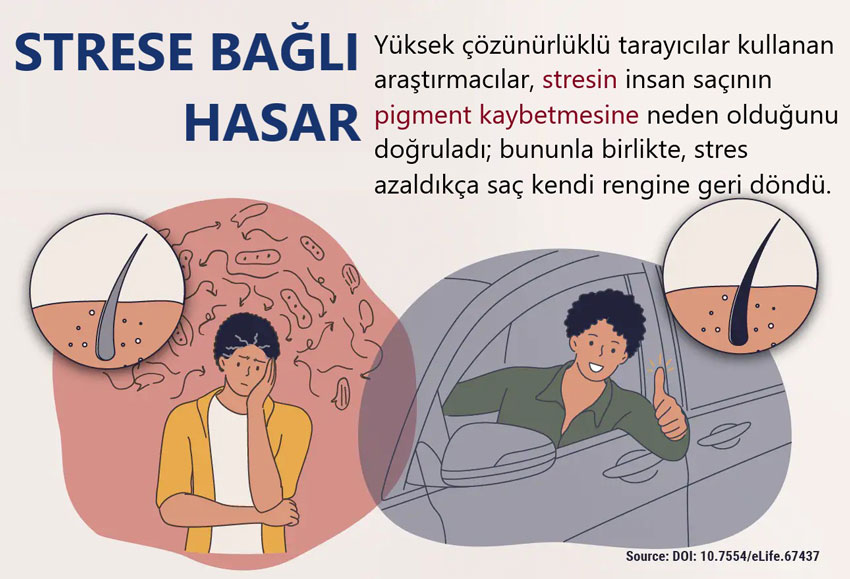 Die wissenschaftliche Bestätigung einer lange bestehenden Theorie und neue Forschung zu einem Zusammenhang mit Alzheimer rückten Stress in den Vordergrund