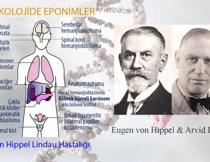 Von Hippel-Lindau Hastalığı Nedir? Adı Nereden Gelmektedir?