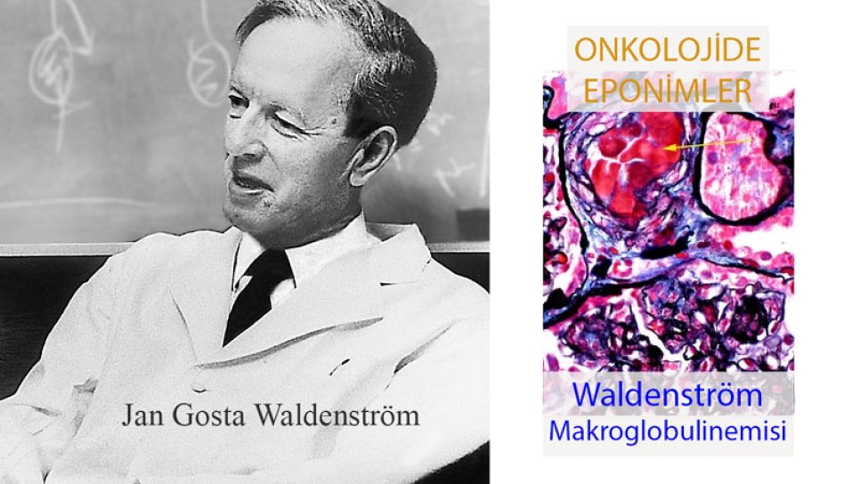 Waldenström Makroglobulinemisi Nedir İsmi Nereden Gelmektedir