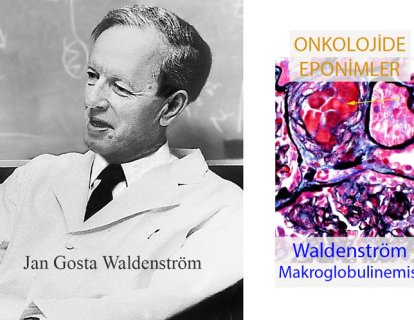 Waldenström Makroglobulinemisi Nedir? İsmi Nereden Gelmektedir?