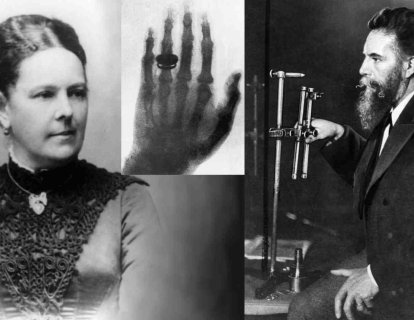 X Işınları 1895 – İnsan Vücudunun Ötesi