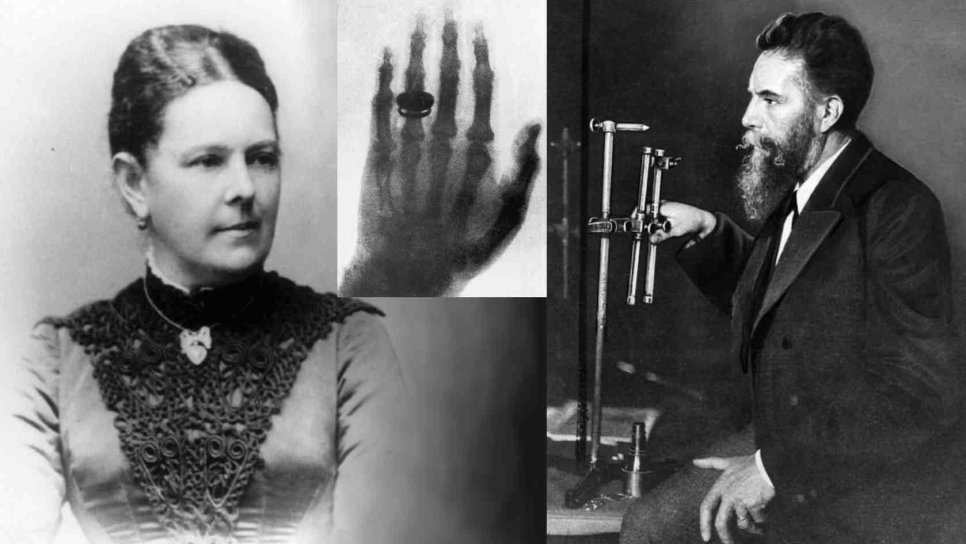 X Işınları 1895 – İnsan Vücudunun Ötesi