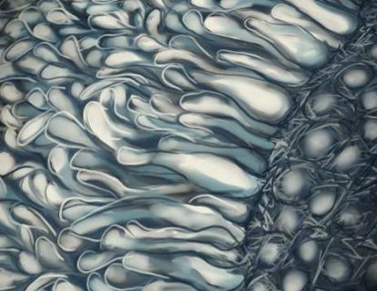 Yüksek yağlı diyetlerin kolon kanserinin büyümesini nasıl desteklediği keşfedildi