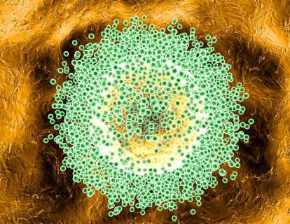 Yaşlanan mikroçevre, kanser oluşumunu ve ilerlemesini nasıl destekler?