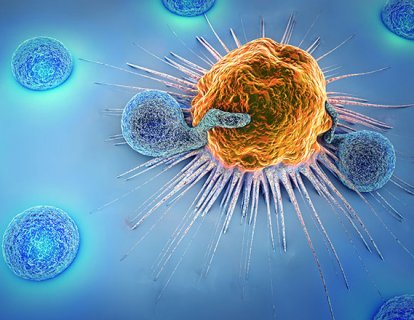 Yeni Bir CAR T-Hücre Tedavisi Öncül B Hücreli ALL İçin FDA Onayı Aldı