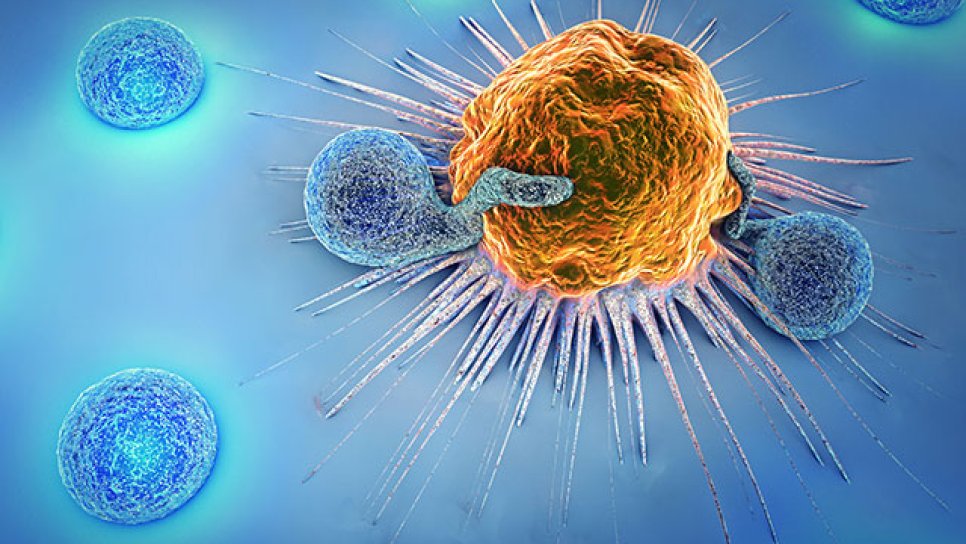 Yeni Bir CAR T-Hücre Tedavisi Öncül B Hücreli ALL İçin FDA Onayı Aldı