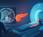 Early Detection of Pancreatic Cancer: MRI for New-Onset Diabetes, AI for Legacy CT Scans