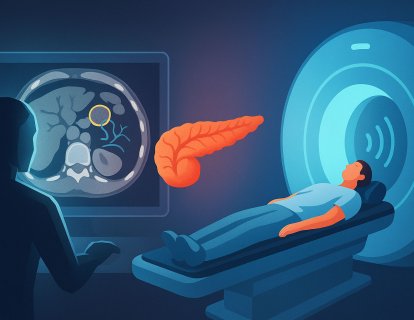 Early Detection of Pancreatic Cancer: MRI for New-Onset Diabetes, AI for Legacy CT Scans