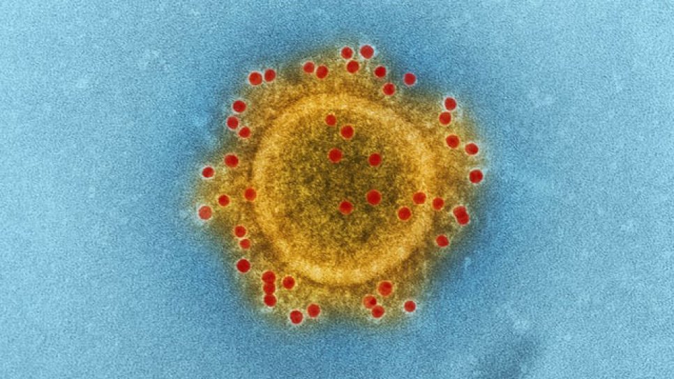 Medikamente, die beim neuen Coronavirus erprobt werden und bei früheren Coronaviren (MERS-CoV und SARS-CoV) wirksam waren
