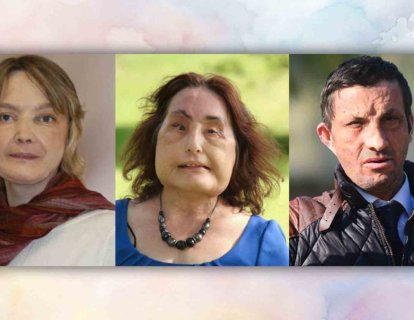 Yüz Nakli 2005 – Hayatın Değişen Yüzü