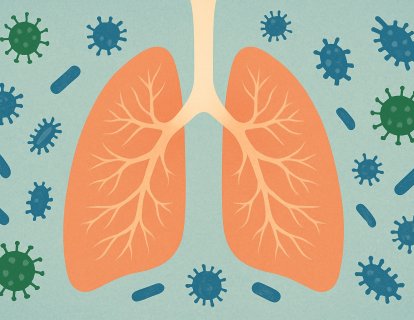 Zatürre (Pnömoni) Nedir, Kanser Hastalarında Neden Daha Sık Görülür?