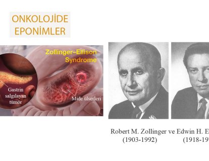 Zollinger-Ellison Sendromu Nedir? Adı Nereden Gelmektedir?