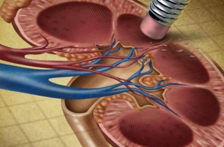 4. Evre Böbrek Kanseri İçin FDA, Lenvatinib Adlı İlacın Everolimus ile Birlikte Kullanımına Onay Verdi