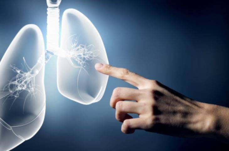 Akciğer Kanseri Hakkında Gerçekler