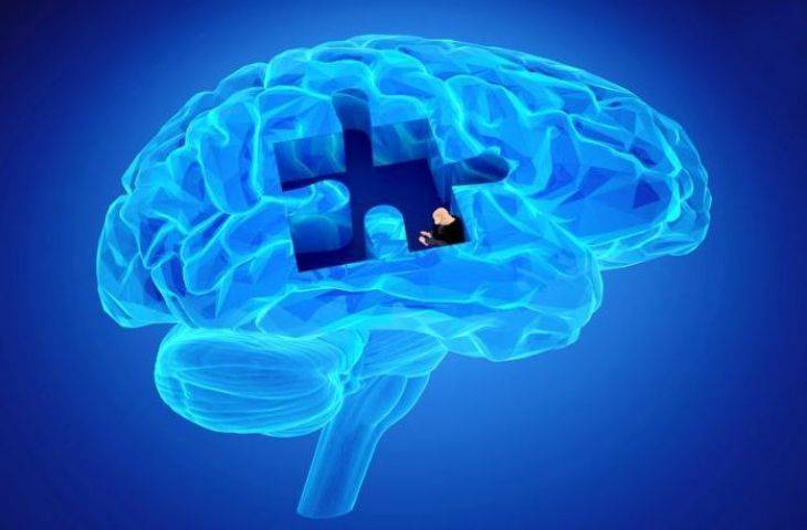 Alzheimer’da Bilişsel Bozukluklarda Kullanılan Donepezil, Beyin Radyoterapisi Alan Hastalarda da Faydalı Mı?