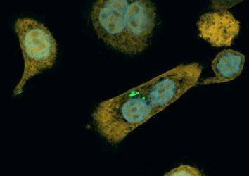 Bakterilerin kemoterapi ilaçlarını parçaladığı keşfedildi