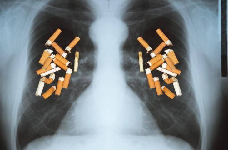 1 Yıl Boyunca Günde 1 Paket Sigara Akciğer Hücrelerinde 150 Mutasyona Neden Oluyor