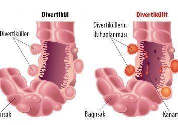 Divertikülit nedir? Kalın bağırsak kanserleriyle ilişkisi var mıdır?