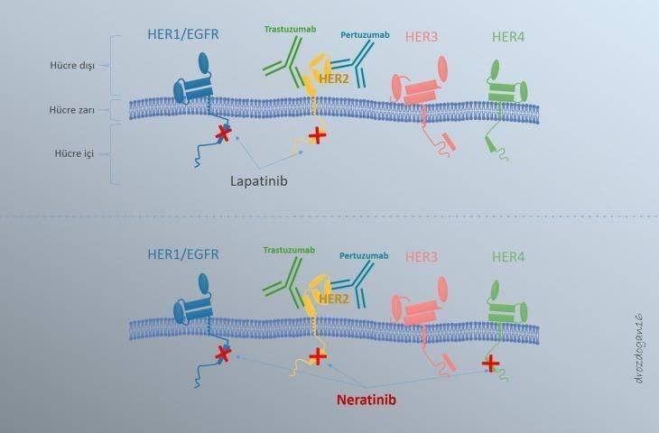 Erken Evre Meme Kanseri Tedavisinde Yeni Bir İlaç: Neratinib