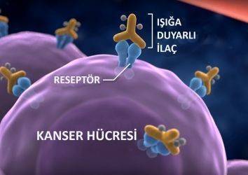 Fotoimmünoterapi: Kanserde hedeflenmiş immünoterapi yöntemi