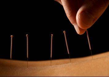 Kanser tedavisinde akupunkturun yeri var mı?