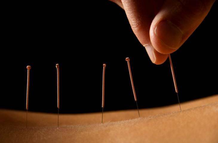Kanser tedavisinde akupunkturun yeri var mı?