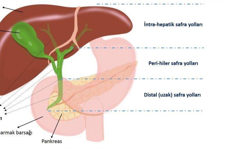 Kanser Türlerine Göre Tanı ve Tedavi Bölümüne Safra Yolu Kanserleri (Kolanjiokarsinomlar) Eklendi