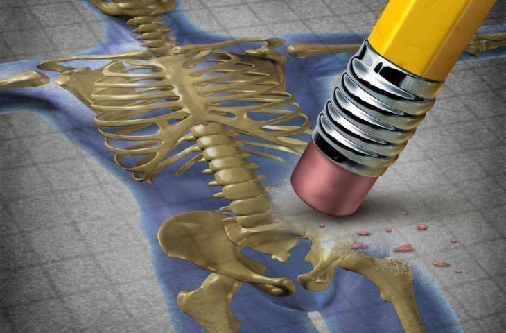 Kemik erimesi ilacı Denosumab, aromataz engelleyici ilaç tedavisi alan meme kanserli hastalarda hastalığın ilerleme ve yineleme riskini azaltıyor