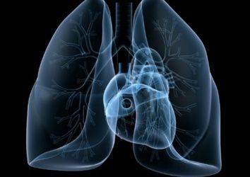 Küçük Hücreli Akciğer Kanserinde Göğüs Duvarı Radyoterapisi Avantaj Sağlayabilir Mi?