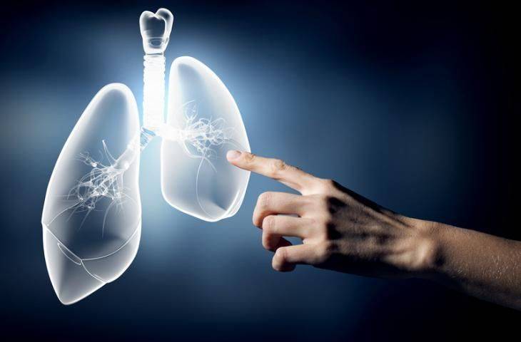 Lenf nodları, 4. evre akciğer kanserinde de önemli bir belirleyici