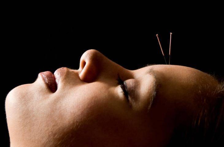 Meme kanserli hastalarda ateş basması tedavisi için akupunktur