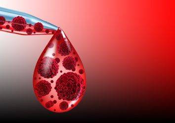 Multiple myelomda otolog kök hücre nakli sonrası lenalidomid yaşam sürelerini uzatıyor