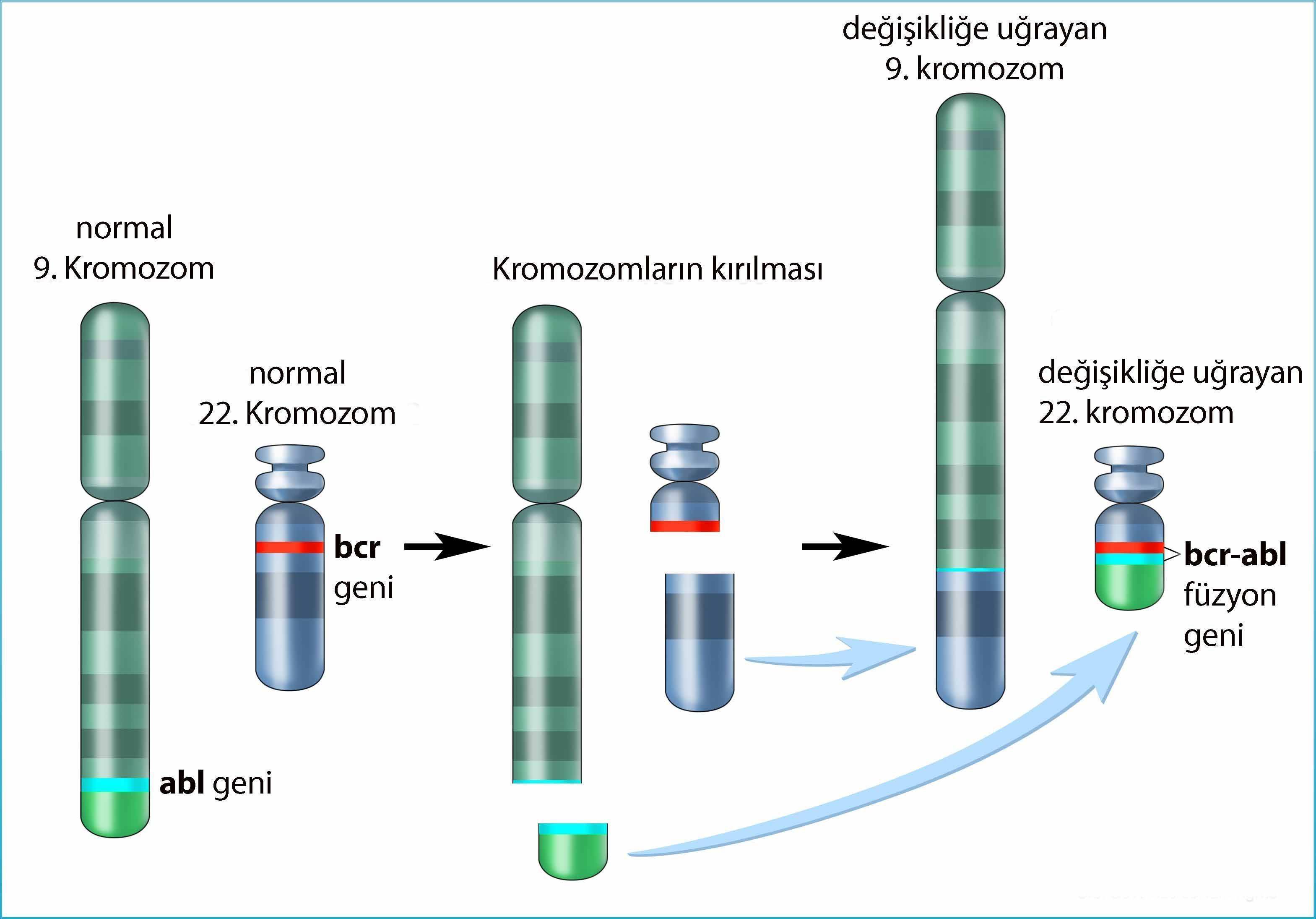 Philadelphia kromozomu KML kronik miyeloid lösemi brc abl füzyon geni