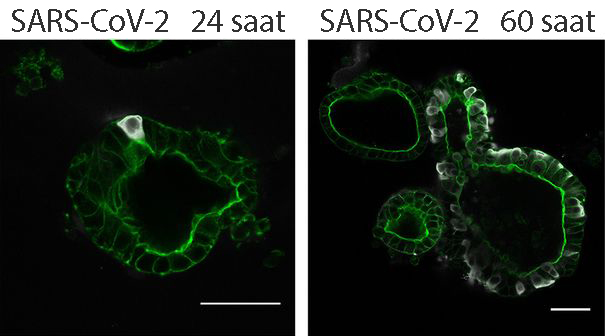 SARS CoV 2 ile enfekte olmuş bağırsak organoidlerinin elektron mikroskobu görüntüsü
