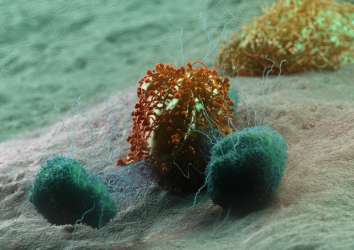 Abskopal etki: Bağışıklık sisteminin gizli gücü ile kanser tedavisi – Gerçek mi abartı mı?