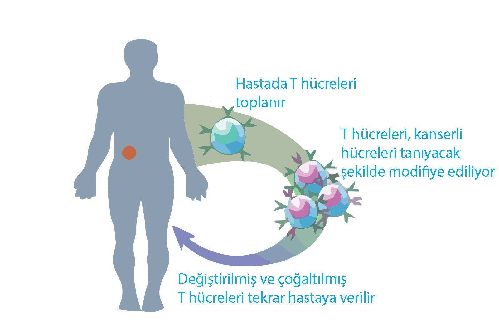 adoptiv t hucre tedavisi yumurtalik kanseri losemiler