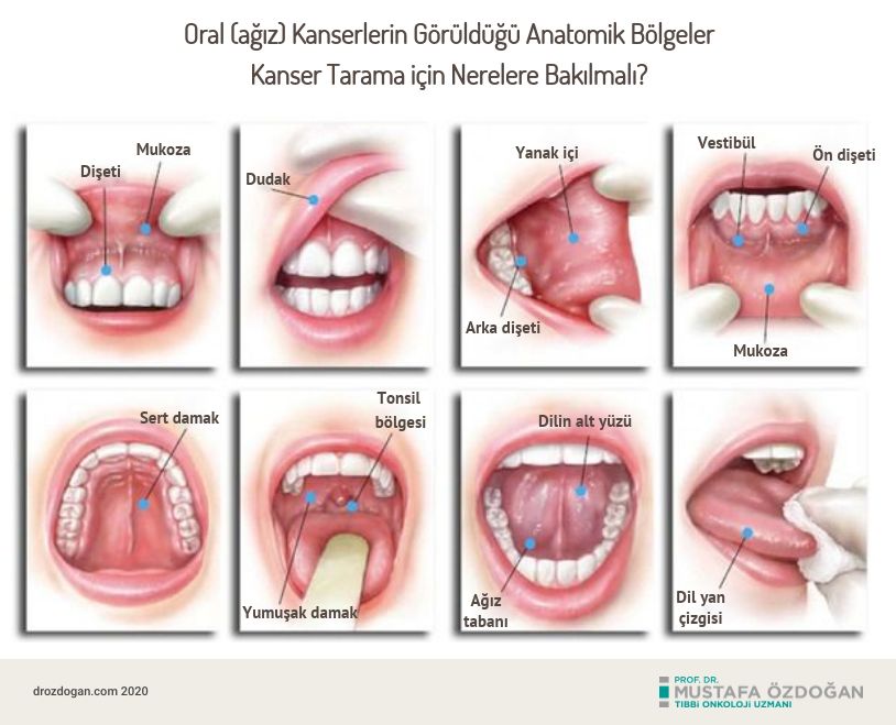 agiz oral kanser goruldugu anatomik bolgeler tarama