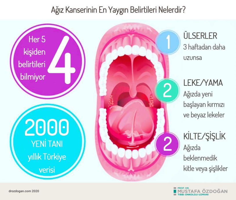 agiz oral kanseri belirtileri nelerdir