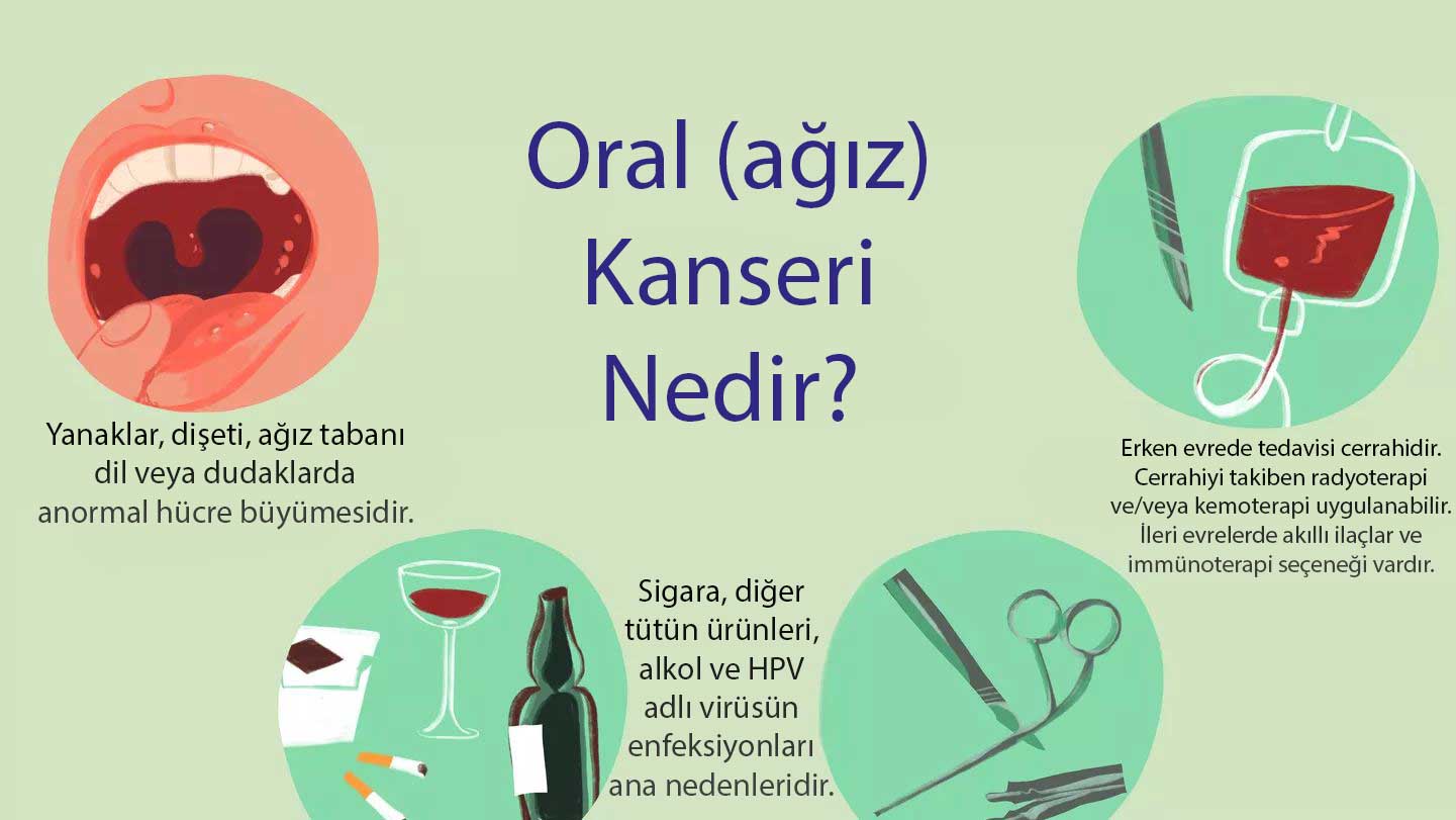 Ağız oral kanseri nedir belirtileri nedenleri tedavisi