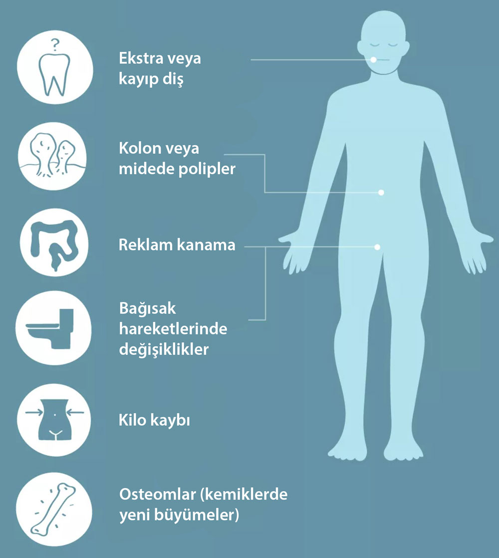 Ailesel adenomatöz polipozis fap belirtileri nelerdir