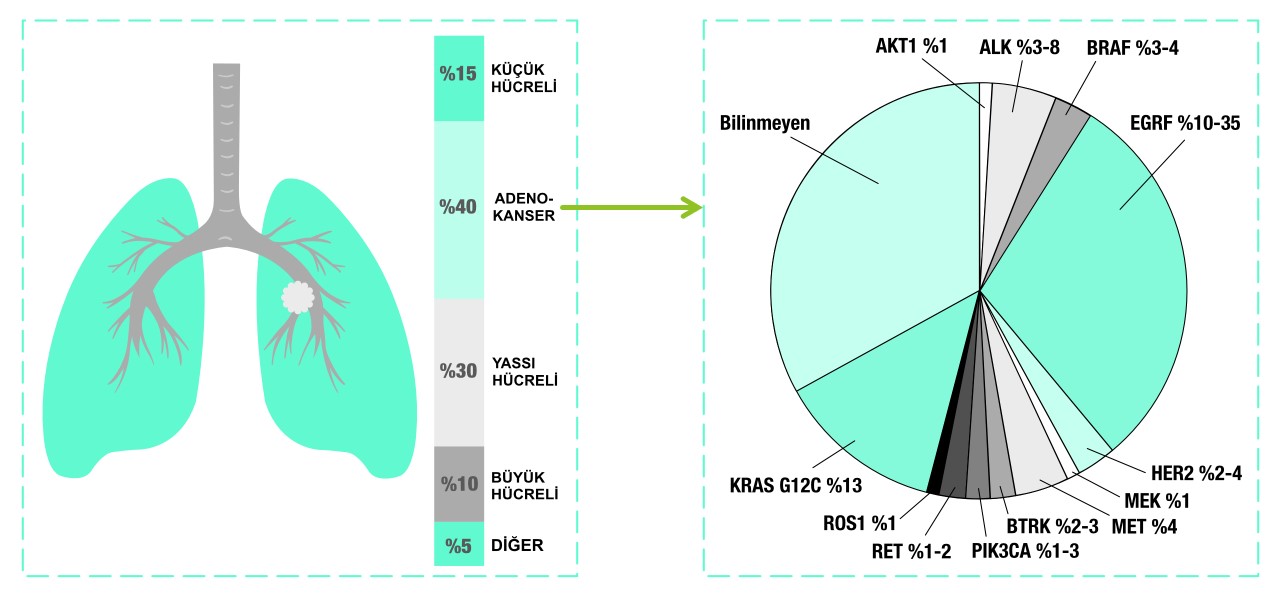 akciğer adenokanser alt türleri