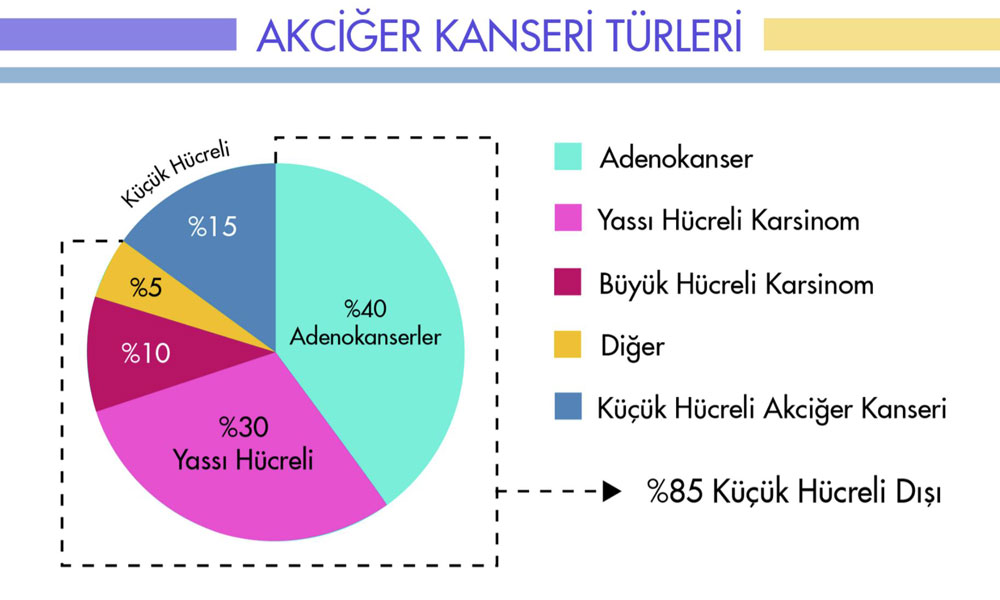 akciğer kanseri türleri çeşitleri büyük küçük hücreli dışı karsinom