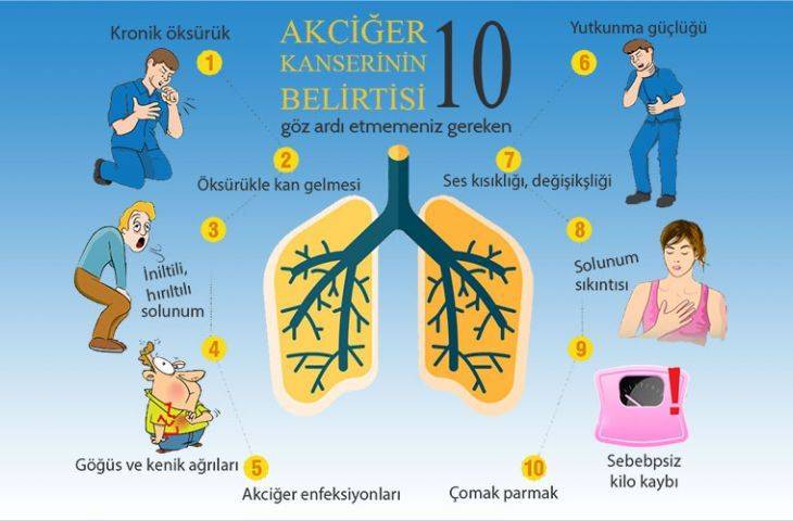 Akciğer kanserinin belirtileri nelerdir?