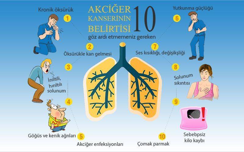akciğer kanserinin dikkat edilmesi gereken 10 belirtisi