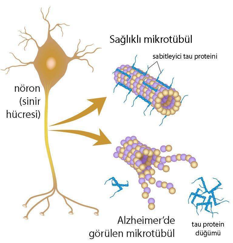alzheimer tau proteini nedir mutasyon kanser riski