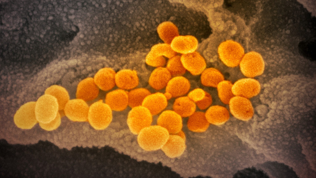 bir hücreyi parçalayıp çıkan yeni koronavirüslerin sars cov 2 elektron mikroskop fotoğrafı